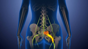 This stock image illustrates sciatica nerve pain, extending from the lower back through the hips to the leg. It highlights the anatomy of the human spine, joints, and nervous system, focusing on inflammation and chronic pain. Emphasizing medical and biological aspects, it details spinal health, injury, and the impact on mobility, showcasing symptoms, diagnosis, and potential treatments.